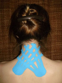 Kinesio Taping on Upper Back & Neck